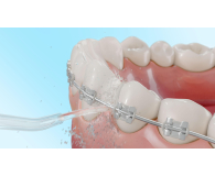 Cecotec TOOTH CARE 1200 - 1376806 - zdjęcie 8